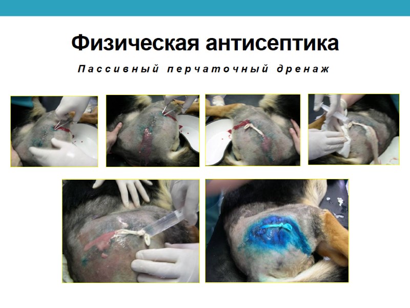 Физическая антисептика П а с с и в н ы й   п